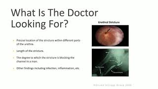 Patient Counseling  Retrograde Urethrogram amp Voiding Cystourethrogram [upl. by Lila357]