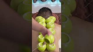 ASMR 火罐🔥  Cupping Therapy  Massage Body [upl. by Motch]