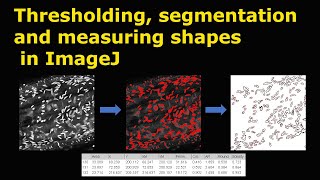 Thresholding segmentation and measuring shapes in ImageJ [upl. by Salbu]