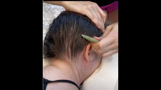 Scalp Scraping asmr With combing 👂 ear neck and back cracks shorts [upl. by Rubenstein66]