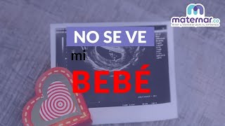 Ecografía 4D el bebé con 18 semanas de gestación [upl. by Elstan981]