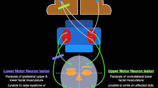 Facial Palsy Upper and Lower Motor Neuron Lesions  Dr MDM [upl. by Initsed676]