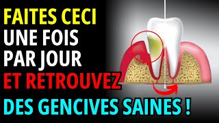 3 habitudes miraculeuses pour assainir et restaurer vos gencives  gencive douloureuse qui saigne [upl. by Sydalg]