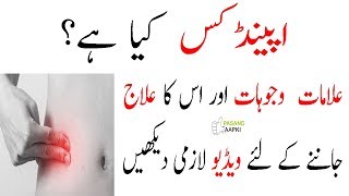 appendix pain  appendix surgery  appendices in urdu with Dr Khurrampasand aapki [upl. by Drahser]