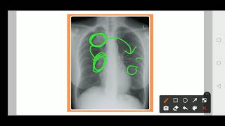 Practical medicine Xray Practice  3 [upl. by Hart]