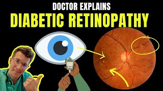 Doctor explains DIABETIC RETINOPATHY eye disease  STAGES SYMPTOMS PREVENTION AND TREATMENT [upl. by Olimac]