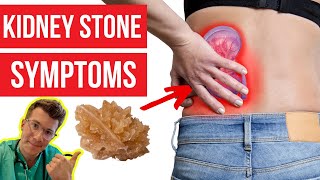 What symptoms do KIDNEY STONES cause Doctor explainsPLUS how kidney stones are diagnosed amp more [upl. by Lev]