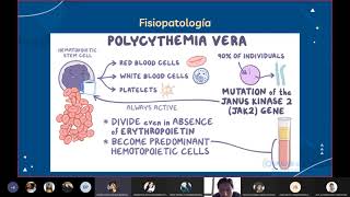 PV Algoritmo dx del pcte con trombocitosis Trombocitemia esencial y Leucocitosis [upl. by Nylahs261]