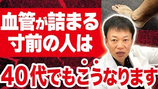 【他人事じゃない】動脈硬化の直前に現れる３つの危険なサインとは？（血管が詰まる・心筋梗塞・脳梗塞） [upl. by Delinda]