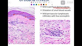 MSS pathology lab 1  part 1 [upl. by Haff]