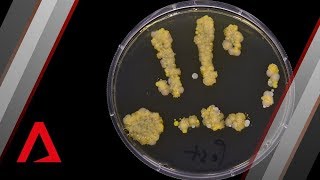 The bacteria living on your hands right now [upl. by Iznek52]