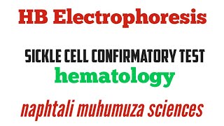 Hematology HB Electrophoresis  Sickle cell [upl. by Lenhard]