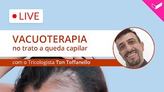 Vacuoterapia no trato a queda capilar com Ton Toffanello [upl. by Cissiee]