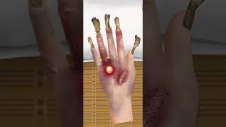 Hand hole remove and cleaning  Finger ring remove  viral animation skincare makeupanimation [upl. by Enilrahc32]