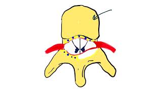 Brain Abscess amp Spinal Epidural Abscess full video [upl. by Nodnelg]