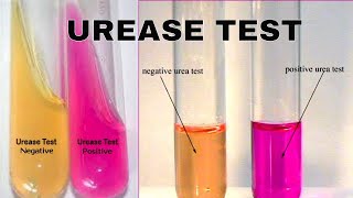 Urea Hydrolysis Urease Test [upl. by Teressa596]