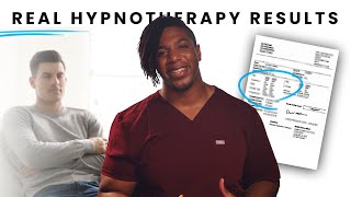 The Benefits of Hypnotherapy per Research 2024 [upl. by Yvi]