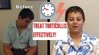 Effective Torticollis Treatment INCREDIBLE RESULTS [upl. by Fulviah]