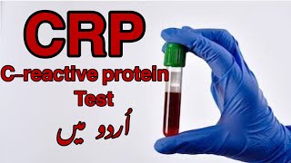 CRP Test In Urdu  What does a high CRP level mean  What does CRP test show What is a normal CRP [upl. by Orsa]