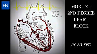 Mobitz I 2nd Degree Heart Block Animation and ECG Shorts [upl. by Nolyag]