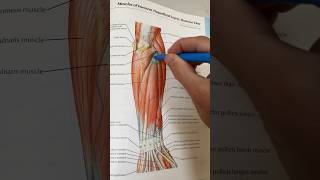 How to Get Rid of Tennis Elbow [upl. by Tade]