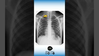 🔻 Anatomie VS Radiologie [upl. by Alcinia783]