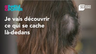 Je vais découvrir ce qui se cache làdedans  Dr Pimple Popper [upl. by Annaili]