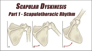 Fix Your Scapular Dyskinesis Part 1  Scapulothoracic Rhythm Exercises [upl. by Lynad791]