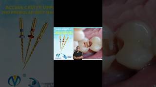 Endodontic Treatment upper Second Premolar single visit Endodontic treatment الكربولة endodontics [upl. by Ragas]