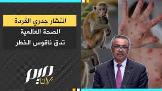 انتشار جدري القردة الصحة العالمية تدق ناقوس الخطر [upl. by Favata179]