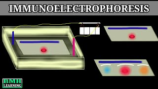 Immunoelectrophoresis [upl. by Anyg]