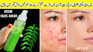 Homemade NEEM FACEWASH For Acne Pimples amp Spots🌿 Get Spotless  Crystal Clear Glass Skin In 7 Days [upl. by Amerak]