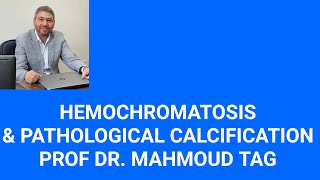 Hemochromatosis and pathological calcification [upl. by Nhguaved1]