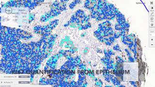 Fully automated epithelial cell proliferation analysis [upl. by Rovaert]