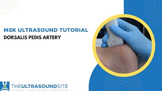 How to find the Dorsalis Pedis artery on MSK ultrasound of the foot [upl. by Ianej]