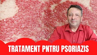 CE POTI FACE IN PSORIAZIS [upl. by Tterag]