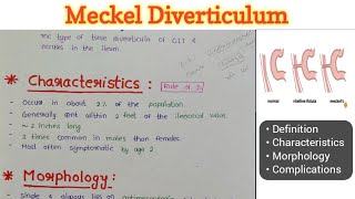 Meckel Diverticulum  GIT Pathology [upl. by Malia867]