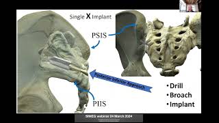 SIMEG Webinar on Biomechnis lecture 06 1 [upl. by Nerej470]