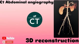 How did you make this  3D reconstruction abdominal Angiography  Ct Ge 32 revolution [upl. by Nnylatsyrk]