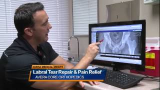 Labral tear repair and pain relief  Medical Minute [upl. by Fabrianne]