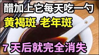 醋加上它每天吃一勺，脸上的老年斑、黄褐斑7天就没了，75岁老中医皮肤跟15岁孙女一样白皙滑嫩，超简单！【饮食养生大智慧】 [upl. by Suivatnod470]