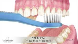 Limpieza dental  Recomendaciones [upl. by Namzed]