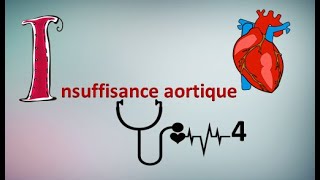 Comprendre linsuffisance aortique en 5 min ⏲️✔️ [upl. by Rochkind]