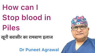 How can I stop blood in Piles  Bleeding Piles Medicine Tablet खूनी बवासीर का रामबाण इलाज [upl. by Ayet]