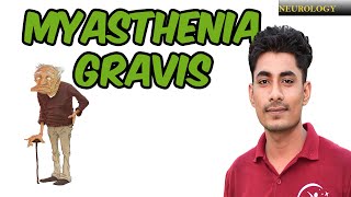 MYASTHENIA GRAVIS  SIGN AND SYMPTOM  MANAGEMENT [upl. by Sadowski]