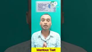 Mantoux Test  TST  PPD Tuberculin Skin Test  Diagnosis of TB shorts tuberculosis shortvideo [upl. by Suiramaj]