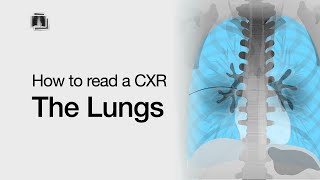 How to Read a Chest XRay The Lungs [upl. by Ennad143]