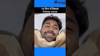 Kidney stone treatment  Retrograde Intrarenal Surgery  FANS RIRS shortsviral [upl. by Malvina600]