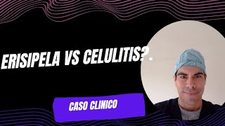 ERISIPELA VS CELULITIS [upl. by Ysirhc]