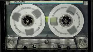 Yeshimebet Dubale የሺመቤት ዱባለ ጐዳናው ምን ይላል Ethiopian Music Oldies [upl. by Risteau950]